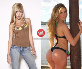 booty implants of Virginia Gallardo