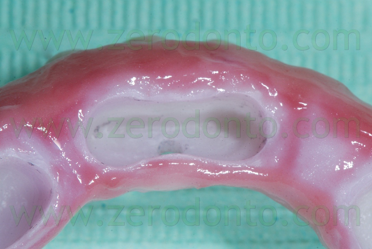 [zirconia-framework2.jpg]