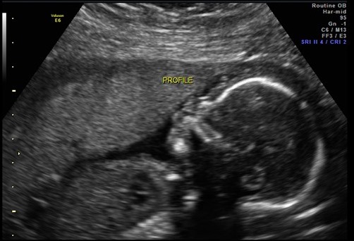 profile profile