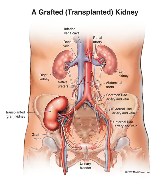 [kidney_large_2%255B5%255D.jpg]
