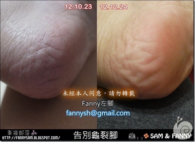 blog-Fanny左腳 blog-Fanny左腳