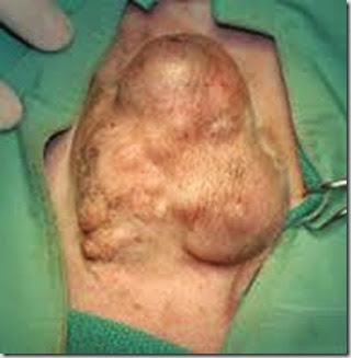tumore mammario cagna 2