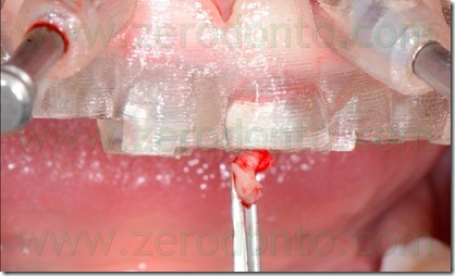 blog.076 blog.076