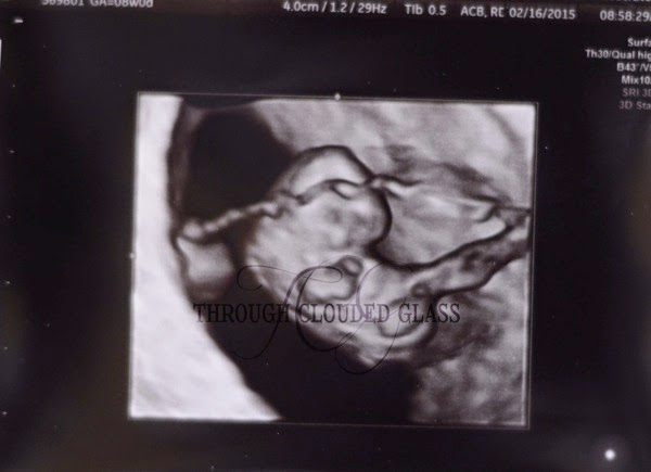 pregnant7.jpg Pregnant7