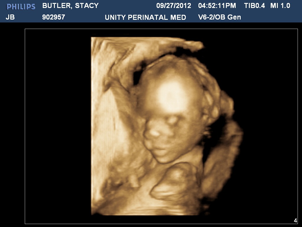 [BUTLERSTACY201209271652119892.jpg]