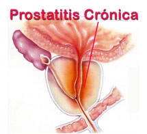 [prostatitis_cronica_peru%255B2%255D.jpg]