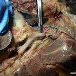 aorta_probe.JPG