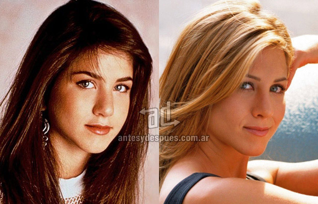 La nueva nariz operada de Jennifer Aniston