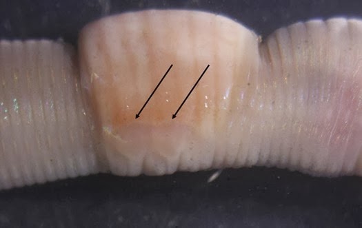 The distinctive two bumps on the TP of Aporrectodea caliginosa 