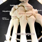 carpals_labeled.JPG