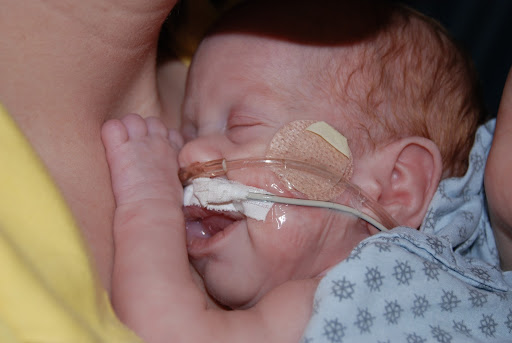 Dylan Brown was 1 lb, 3 oz at birth;  he was in the NICU for about four months, and on oxygen for nearly a year. (Photo used with permisison of Tracey Brown)