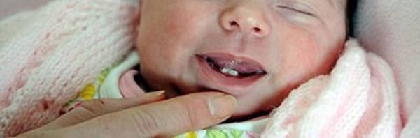 9- bebe com dente 9- bebe com dente