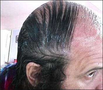 comb_overs_31