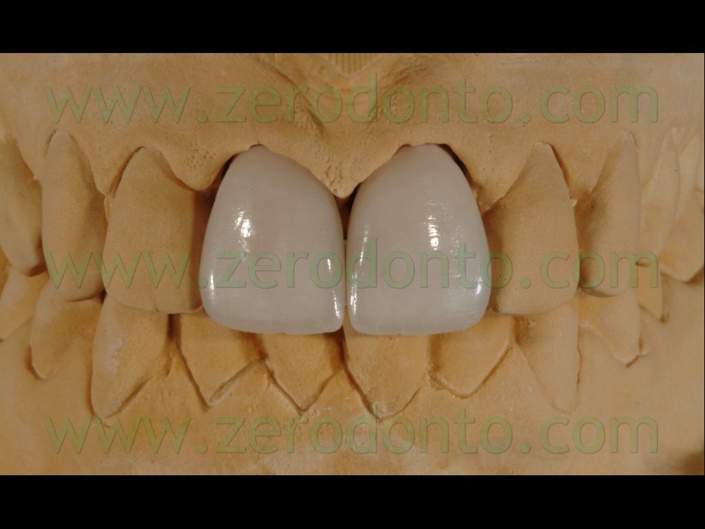 [91-stratificazione-ceramica-glasura-%255B2%255D.jpg]