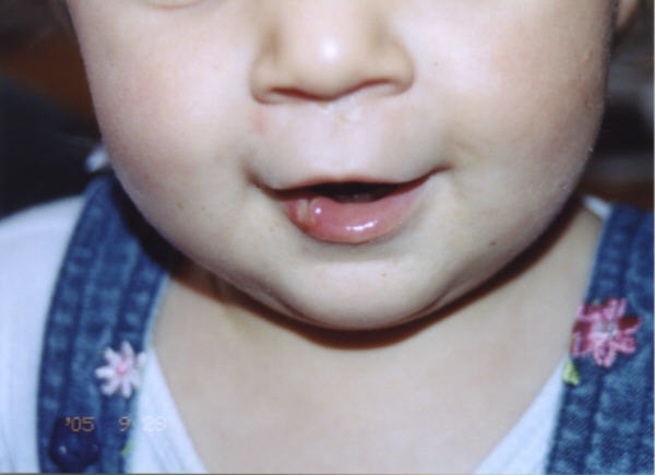 [marie%2520lip%2520day%2520two%25202%255B3%255D.jpg]