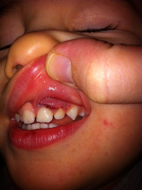 [rams%2520teeth%255B3%255D.jpg]