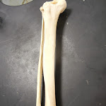 tibia_fibula.JPG