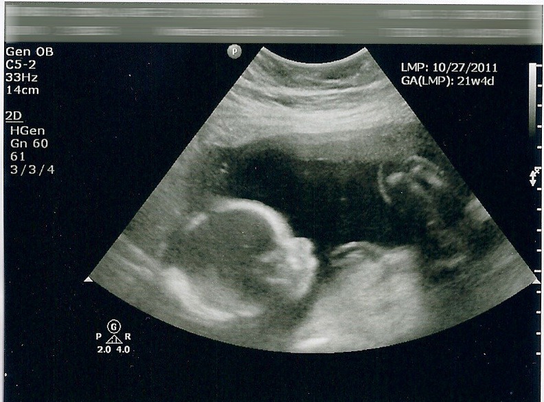 [baby%2520boy%25207%255B4%255D.jpg]