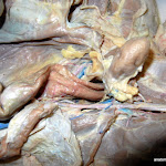 large_intestine.JPG