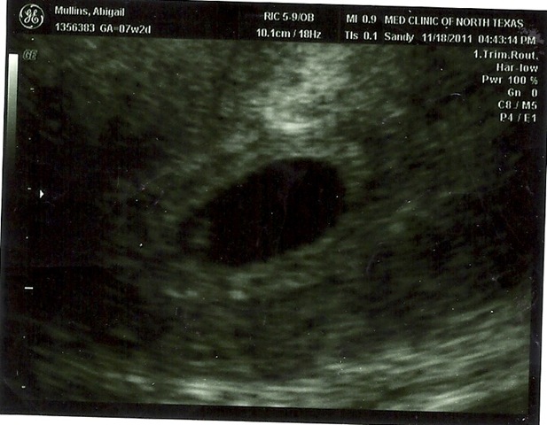 [baby%2520boy%252010001%255B3%255D.jpg]