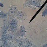 cheek06.jpg