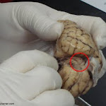 brain_dissect09.jpg brain_dissect09.jpg