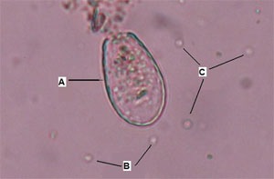 [04_Amoeba_sml2.jpg]