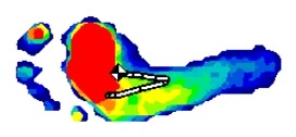 [Foot%2520Pressure%2520Tracing%255B3%255D.jpg]