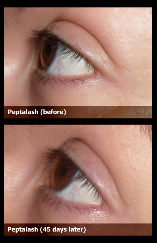 02-peptalash-before-after-result-photo