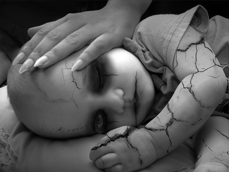 Brittle Skin Baby, Death