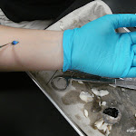 tapetum_accident.JPG