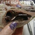 heart_tricuspid_labeled.JPG