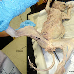gracilis_L.JPG