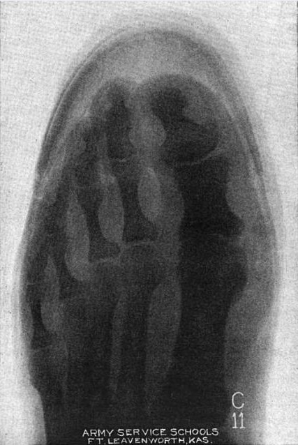 [Munson%2520X-Ray%255B3%255D.jpg]