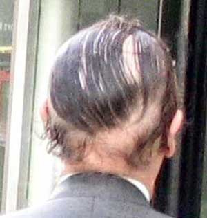 [comb_overs_32%255B2%255D.jpg]