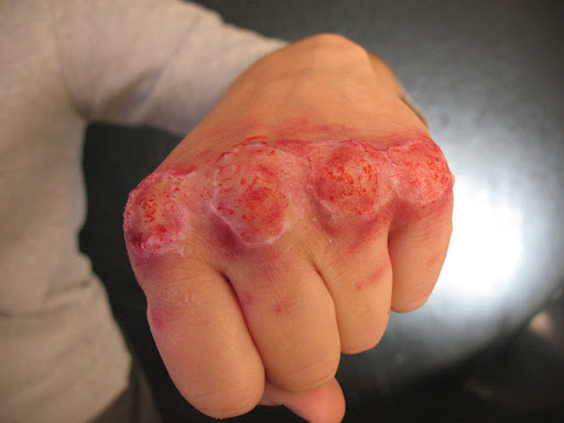 Busted Knuckles