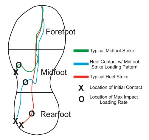 Pressure Tracings Pressure Tracings
