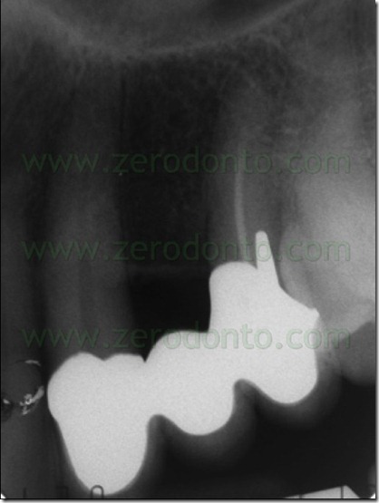 FIG N 20