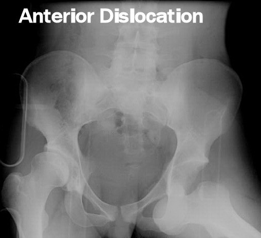 [anterior2%255B1%255D.jpg]
