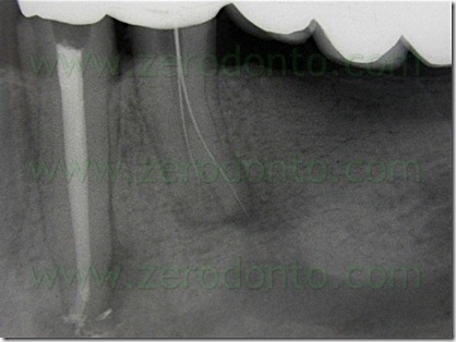FIG N 38
