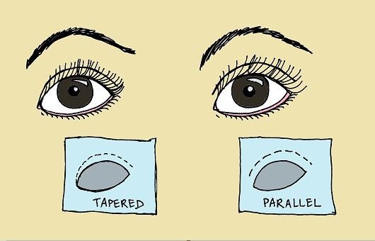 [Eyelids-Tapered-vs-Parallel%255B2%255D.jpg]