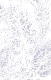 Sigurd Beholds Brynhild