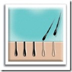 Haarentfernungssystem Haarentfernungssystem