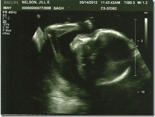 19 wks 3