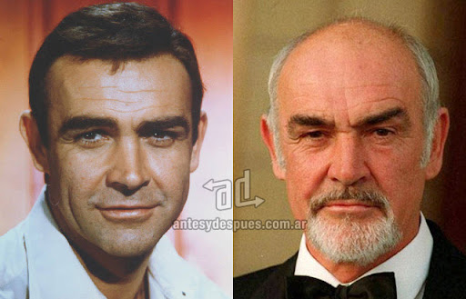 La caida del pelo de Sean Connery