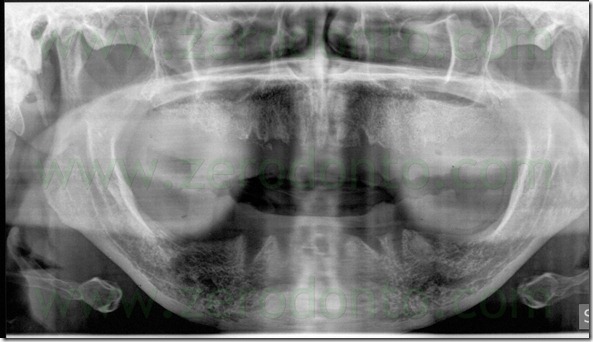 - (7) ortopantomografia