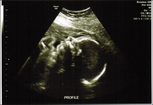profile ultrasound profile ultrasound