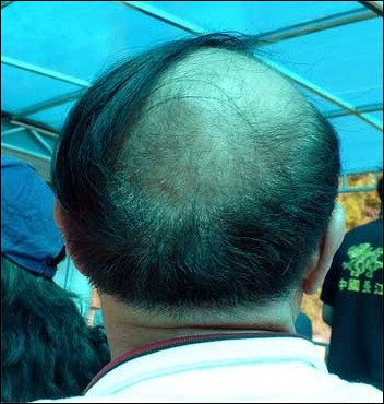 comb_overs_29