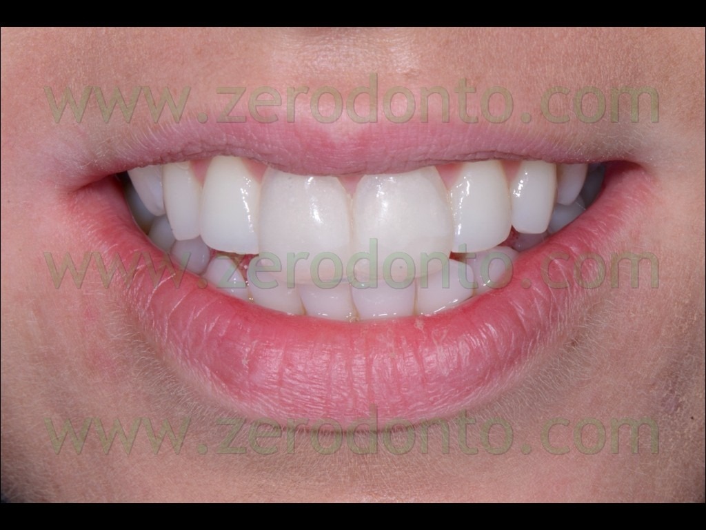 [26-linea-del-sorriso3.jpg]