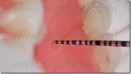 blog.018